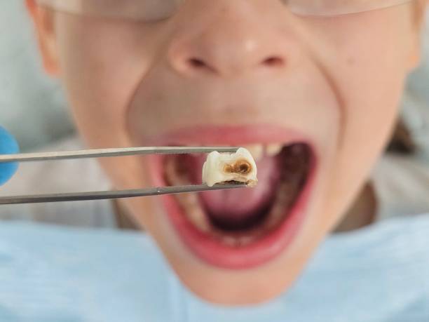 Best Emergency Gum Pain Relief  in Vander, NC